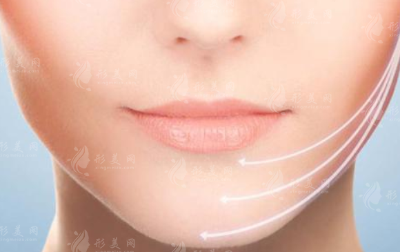 肥胖下頜角整形有后遺癥嗎？能有避免嗎？