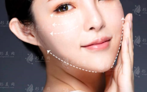 顴骨內(nèi)推術(shù)后要注意什么?