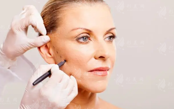 拉皮后出現(xiàn)水腫多久能徹底消腫?