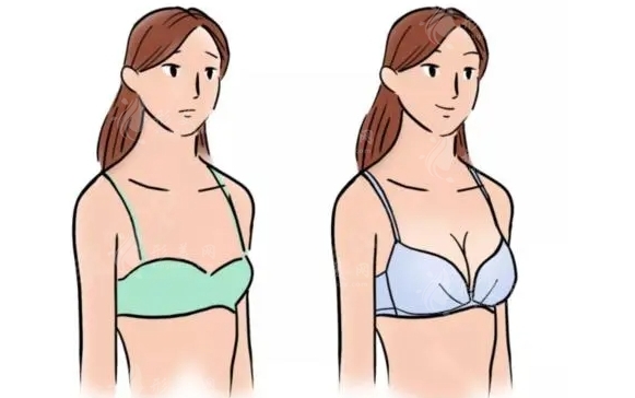 上海九院脂肪填充胸部怎么樣？醫(yī)生名單、2024收費(fèi)價(jià)格表