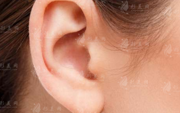 豐耳垂的兩種常用手術(shù)方法是哪些？