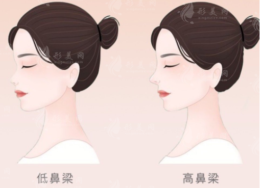 深圳藝星?？溯x做鼻子怎么樣？預(yù)約面診/做自然款媽生鼻2w+