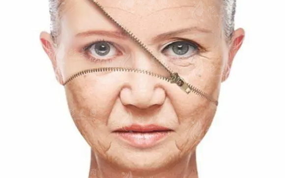 電波拉皮除皺效果如何?可以管多久?