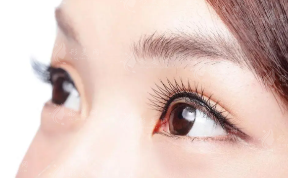 北京師麗麗雙眼皮手術(shù)費多少錢？雙眼皮修復(fù)技術(shù)好嗎？