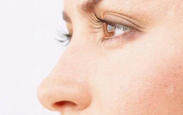 鼻子皮膚薄適合做硅膠隆鼻嗎?