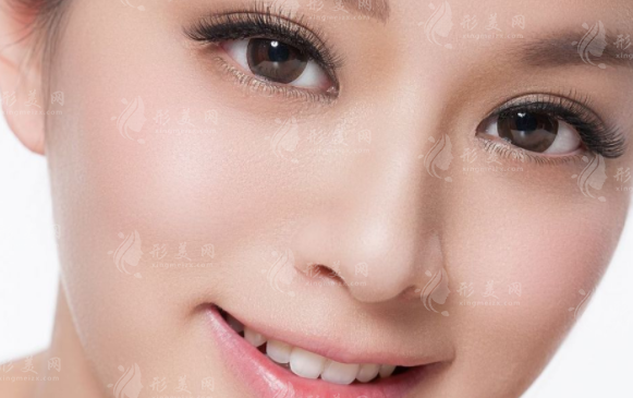 假體隆鼻硅膠和膨體的深入揭秘：區(qū)別、優(yōu)缺點及價格解析