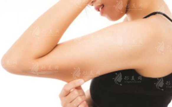 蝴蝶袖手臂吸脂：價(jià)格、保持時(shí)間與恢復(fù)期深度解析