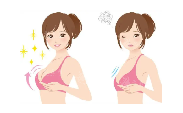 做了脂肪隆胸后可以喂母乳嗎？