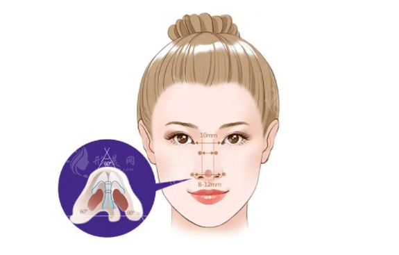 杭州清鍇醫(yī)療美容隆鼻