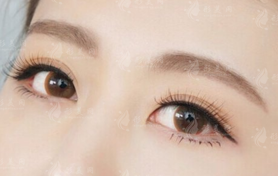 切眉術適合多大年齡做？對于年齡有要求嗎？