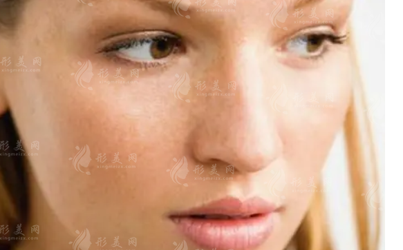 彩光祛斑與激光祛斑：哪個(gè)更貴？祛斑后注意事項(xiàng)大揭秘