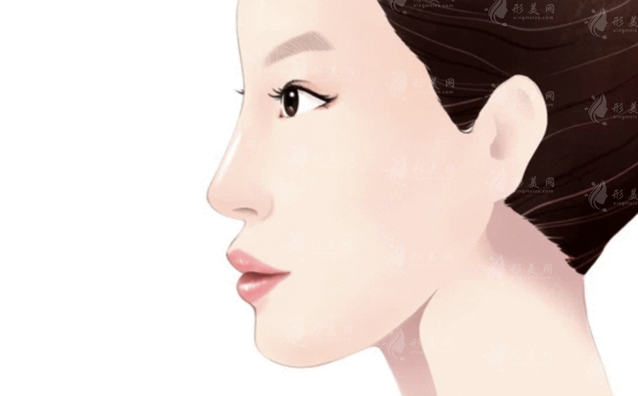 西京醫(yī)院做隆鼻手術(shù)多少錢？好評(píng)醫(yī)生信息/案例分享/價(jià)格表分享