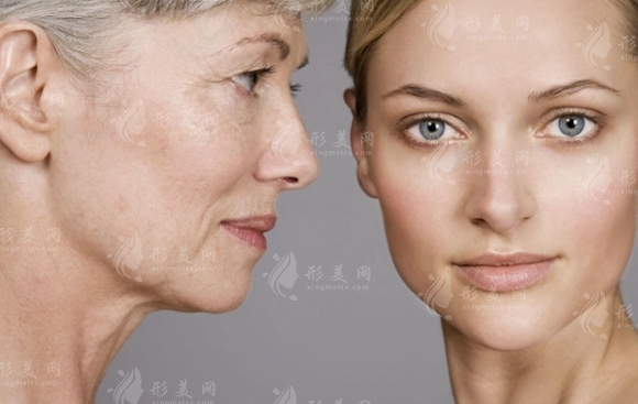 電波拉皮除皺：價格與影響因素分析