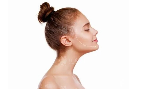 下頜角手術(shù)后多久完全消腫？術(shù)前術(shù)后要注意哪些？