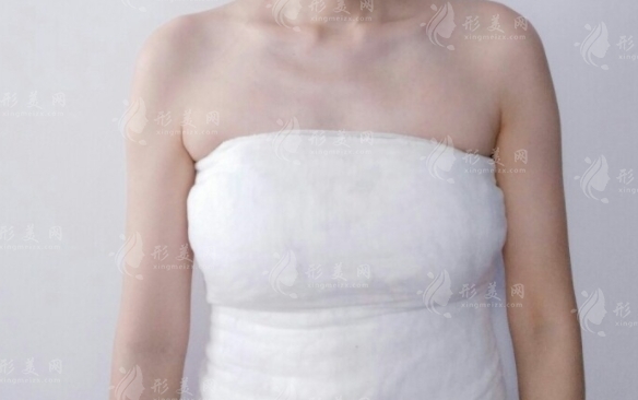 自體隆胸手術(shù)費(fèi)用及相關(guān)因素分析