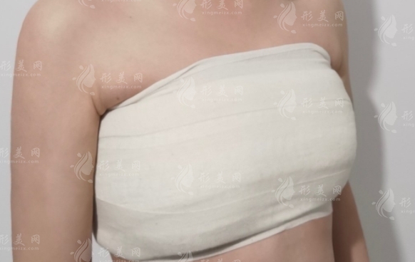 自體隆胸手感和真的一樣嗎？一般要多長(zhǎng)時(shí)間可以恢復(fù)？