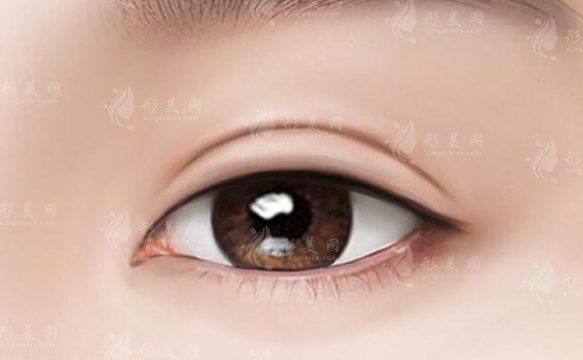 四川悅好醫(yī)學美容雙眼皮怎么樣？案例分享、案例分享、價格表