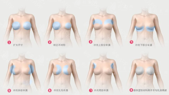 北京八大處乳房整形醫(yī)生排名：探尋欒杰與穆大力的精湛技藝