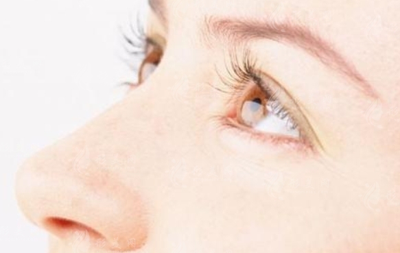 鼻孔縮小術(shù)與鼻翼縮小手術(shù):差異與效果對(duì)比 鼻孔縮小術(shù)與鼻翼縮小手術(shù):差異與效果對(duì)比