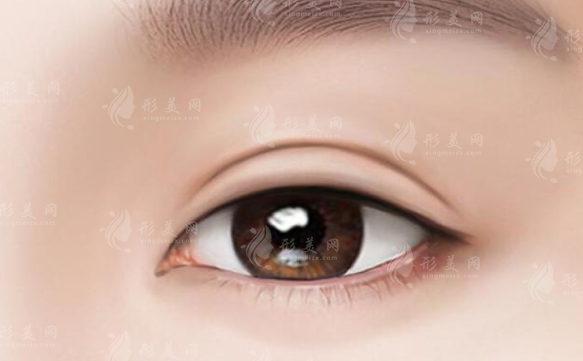 合肥藝星整形雙眼皮怎么樣？醫(yī)生名單、案例分享、新價(jià)格表一覽