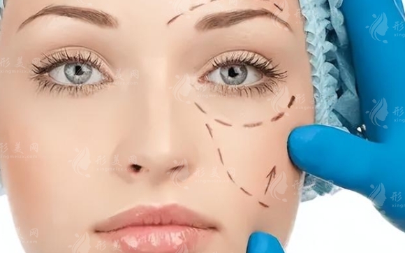 中面部提升術(shù)的后遺癥與效果維持時(shí)間探究