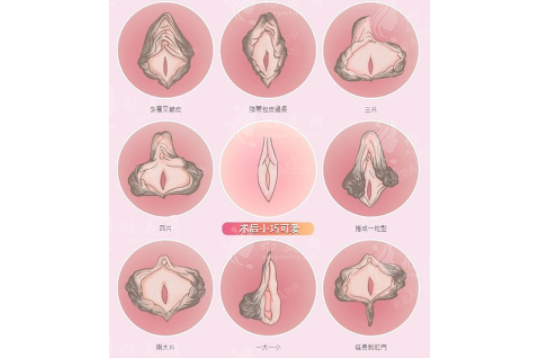 廣州曙光整形醫(yī)院做私密手術(shù)好嗎？郝衛(wèi)潔|張小蕓技術(shù)有保障