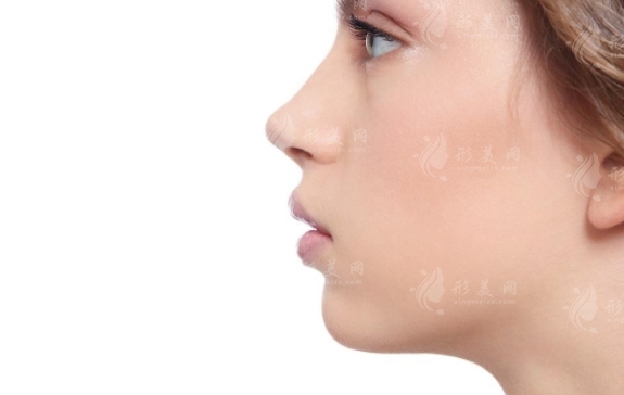 鼻頭鼻翼縮小手術(shù)會增生嗎？恢復期需要多久？