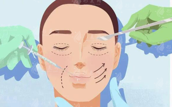 成都銅雀臺做雙眼皮手術多少錢？嚴選專家、案例、價格預覽