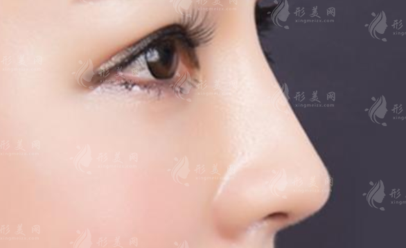 耳軟骨墊鼻尖有什么原理，會穿透鼻尖嗎？