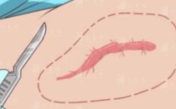 西京醫(yī)院激光祛疤怎么樣？科室實(shí)力、醫(yī)生簡(jiǎn)介、2024價(jià)格表