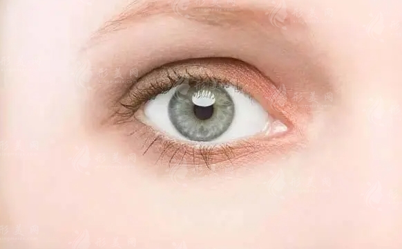 眼瞼吸脂術(shù):手術(shù)過程與眼皮松弛的可能性 眼瞼吸脂術(shù):手術(shù)過程與眼皮松弛的可能性