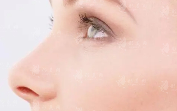 如何預(yù)防鼻尖縮小術(shù)后的增生