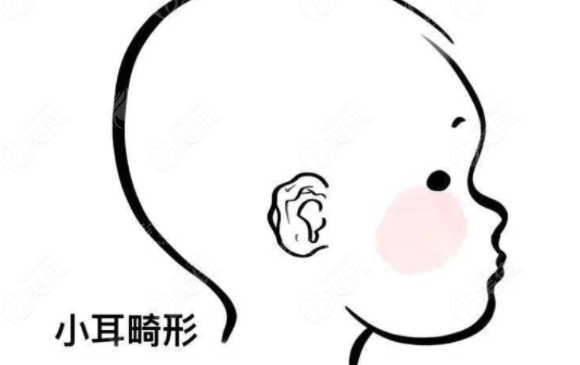 上海九院耳再造技術(shù)怎么樣？專(zhuān)家介紹、案例參考、附收費(fèi)價(jià)格表