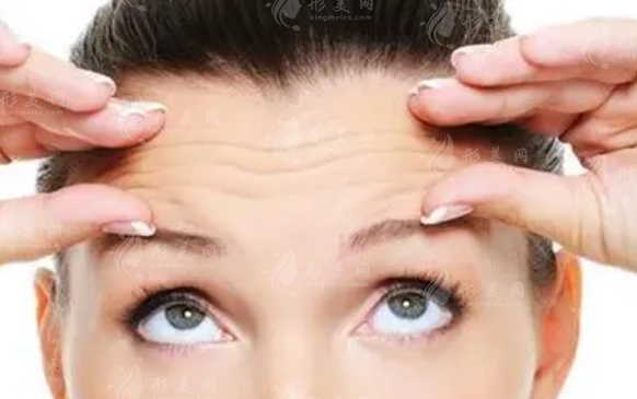 皺紋去除手術(shù)：探索那些可被手術(shù)撫平的歲月痕跡