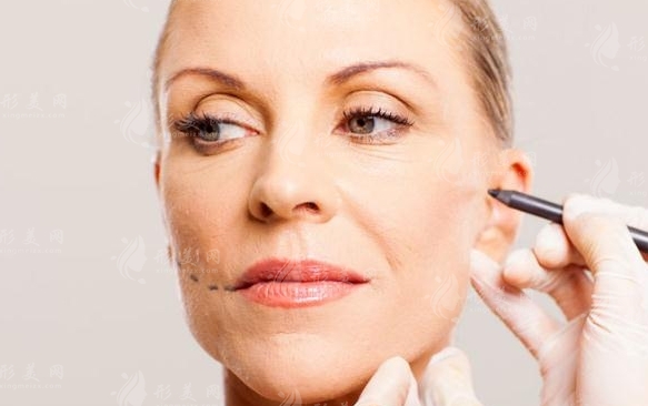 皮膚松弛怎么辦？面部提升方法大揭秘