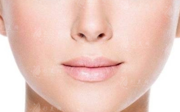 鼻翼縮小術：重塑鼻部輪廓與快速消腫之道