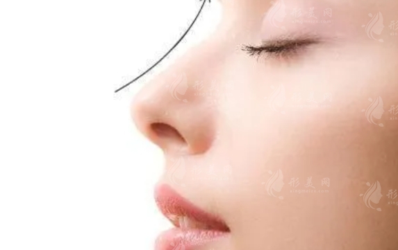 縮小鼻子的方法及其潛在風險