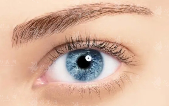 如何判斷自己適合開內眥還是開外眥