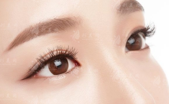 埋線(xiàn)雙眼皮與納米無(wú)痕雙眼皮：哪種更適合你？