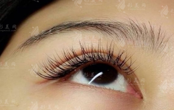 種植睫毛：持續(xù)時(shí)間與注意事項(xiàng)全解析