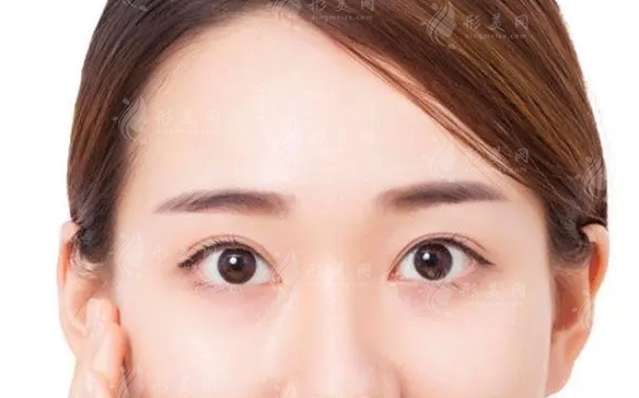 豐額頭手術的后遺癥及效果維持時間