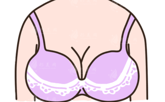 上海玫瑰做豐胸手術(shù)怎么樣？醫(yī)生介紹\隆胸案例\全新價(jià)格表