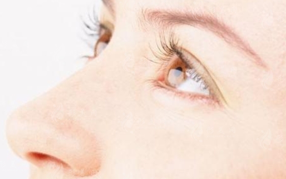 鼻整形修復(fù)手術(shù)后可能出現(xiàn)的問(wèn)題及并發(fā)癥 鼻整形修復(fù)手術(shù)后可能出現(xiàn)的問(wèn)題及并發(fā)癥