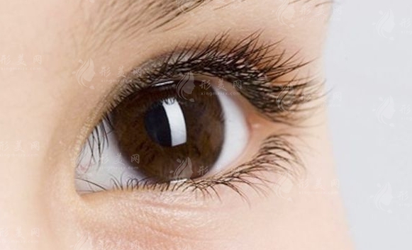 開眼角后回縮怎么辦？開眼角修復(fù)的價格是多少？