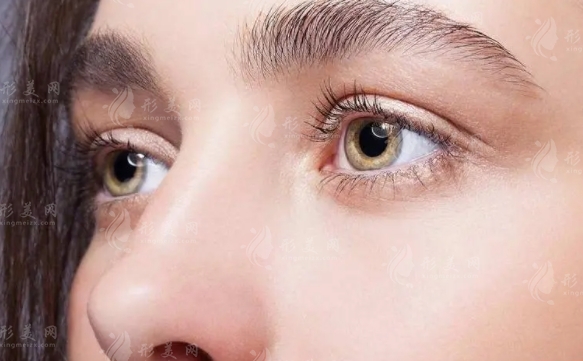 雙眼皮手術(shù)的風(fēng)險與應(yīng)對策略