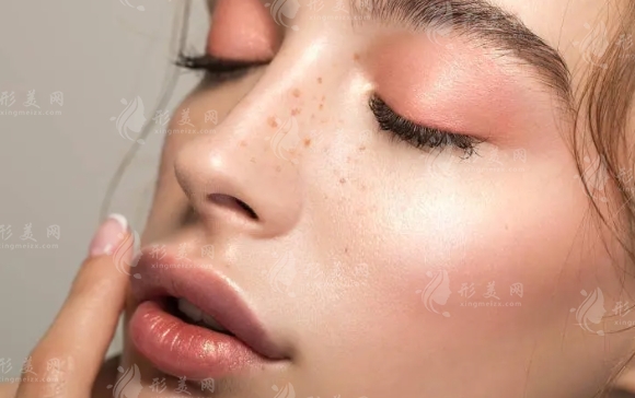 激光祛斑的優(yōu)勢及結(jié)痂脫落時間