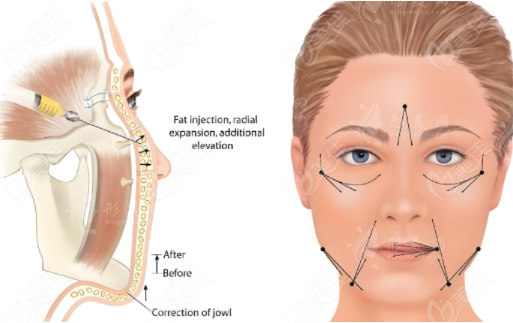 北京黃寺整形醫(yī)院口碑怎么樣？