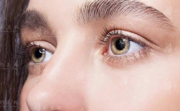 如何讓雙眼皮的肉條消失得更快