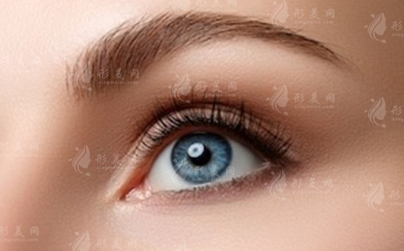 哪些人適合開眼角？開眼角的流程詳解