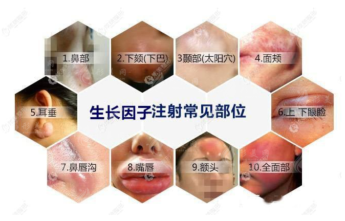 南方醫(yī)院取生長因子費用多少錢？取生長因子影響因素分析